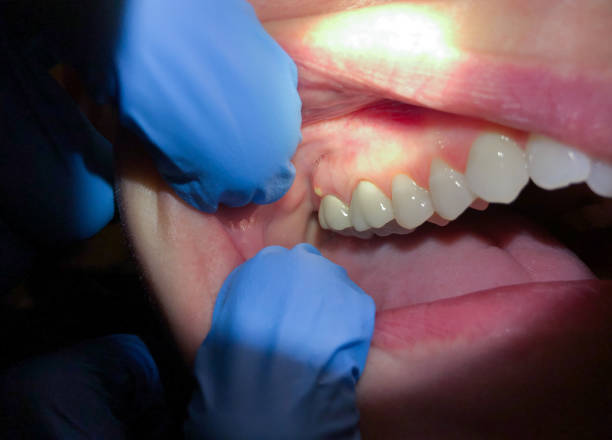 Best Emergency Broken Tooth Repair in Norwood, OK