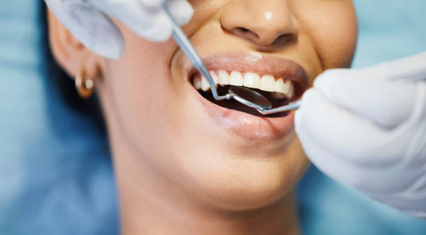 Best Emergency Wisdom Teeth Removal in Norwood, OK